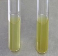 乳糖發酵對照培養基